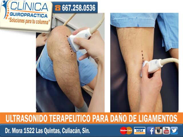 Terapia fisica Culiacán